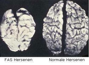 Neuro-anatomische