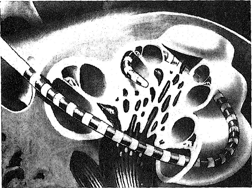 34 L.H.M. MENS ET AL. Fig. 2. Positionering van de electroden in het slakkehuis. (bron: Cochlear A.G,).