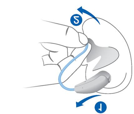Een hoortoestel verwijderen: X Til het hoortoestel op en schuif het over de bovenkant van uw oor ➊. X Houd het slangetje dicht bij het oorstukje en trek het oorstukje voorzichtig naar buiten ➋.