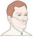 Protocollen Voorbehouden, Risicovolle en Overige handelingen Zuurstof toedienen 4 Toedieningswijzen zuurstof Zuurstof wordt via de neus en/of mond of direct via de luchtpijp toegediend.