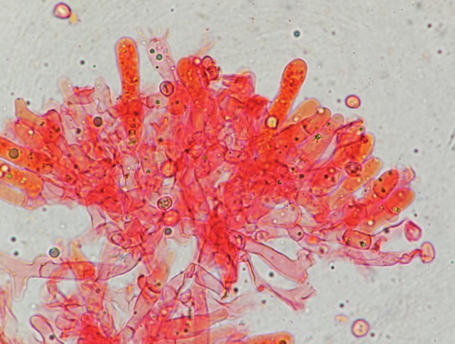 Figuur 4a en 4b. Getand krentenbrijkorstje (Cristinia gallica), hyfen met gespen, basidiën en sporen. (Foto en tekening: Hermien Wassink) opgestuurd, ondanks duidelijke kenmerken.