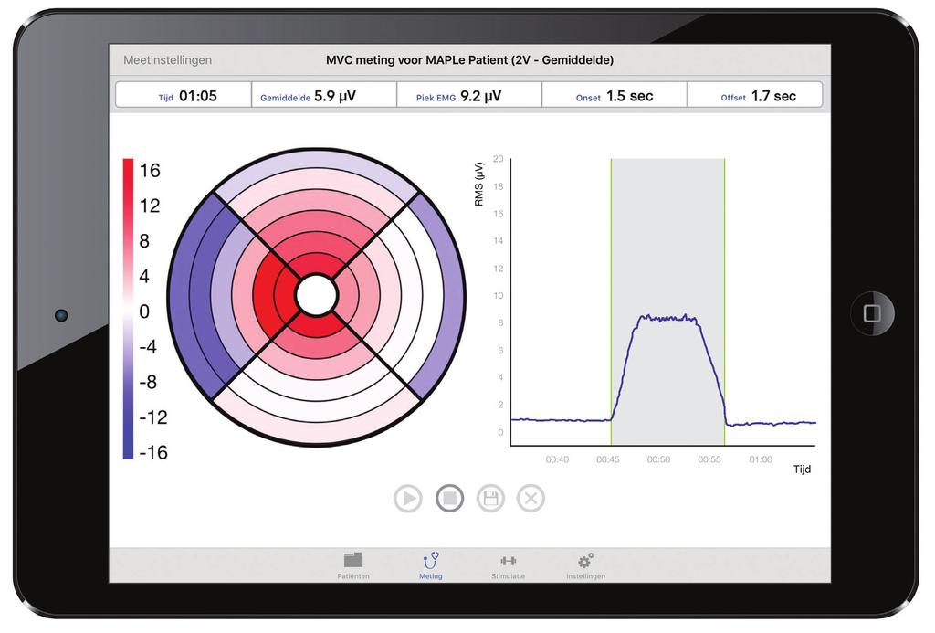 De MAPLe is gemakkelijk te bedienen met een ipad met de MAPLe app U stelt eenvoudig een diagnose en geeft uw patiënt gerichte biofeedback en elektrostimulatie Door de High Definition interface is het