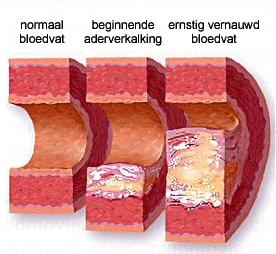 Achtergrond Inflammatie: Betrokken bij afweerreactie lichaam