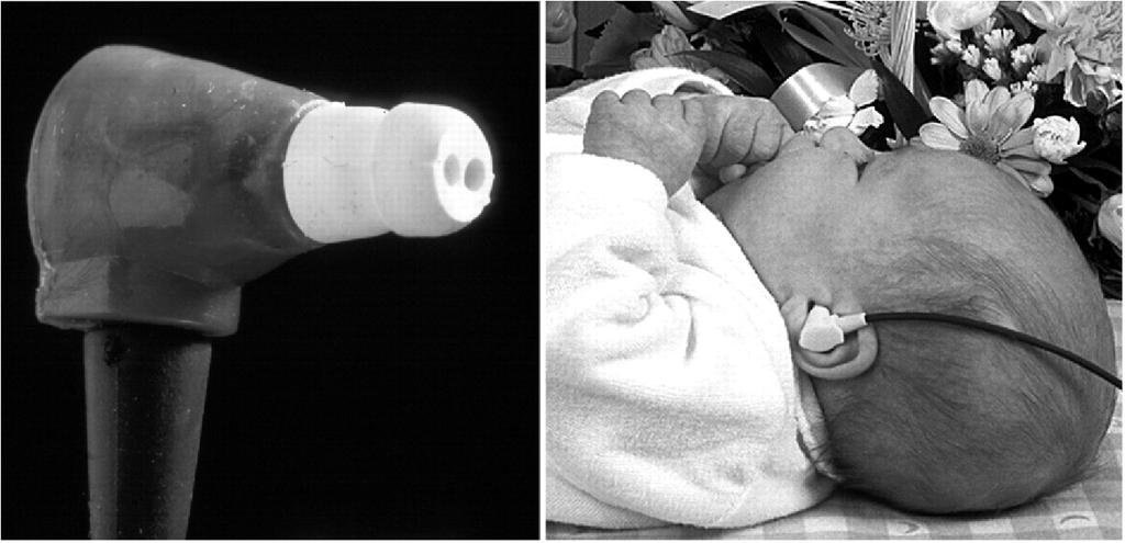 TE-OAE of DP-OAE: neonatale gehoorscreening