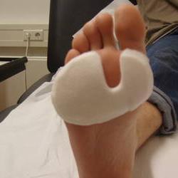 Met welke klachten kan u bij een medische pedicure / gespecialiseerde voetverzorger terecht? Nagels : - Ingegroeide nagels - Schimmelnagels / kalknagels - Afwijkende groei (vb.