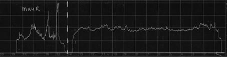 Begin van de boring vrij zachthout, twee holle ruimtes in de console mogelijk bonte knaagkever aantastingen. Visueel enkele uitvliegopeningen in het wapenschild op de kop van de console.