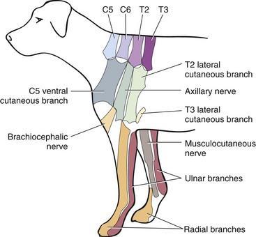 phrenicus kan beschadigd raken daar deze het ruggenmerg ter hoogte van C5-C7 verlaat en zodoende is het diafragma geparalyseerd (Lorenz et al., 2011).