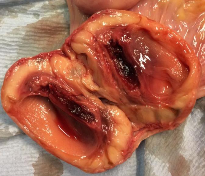 * Foto 2 (links). Lengtedoorsnede van het linker ovarium met de aanwezigheid van een grote follikel van 35 mm (*) en een corpus hemorrhagicum ( ). Foto 3 (rechts).
