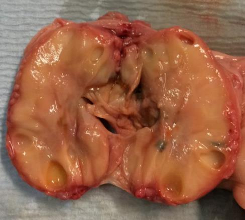 Daarnaast bleek het endometrium minimaal ontwikkeld te zijn (Foto 5), vergeleken met een histologisch beeld van het endometrium van een merrie in oestrus (Foto 6).