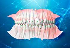 Excent Ortho Bosboom voorziet tandartsen, orthodontisten en hun patiënten van allerhande orthodontie. Van plaat apparatuur tot brackets en alles ertussen. Benieuwd wat orthodontie voor u kan doen?