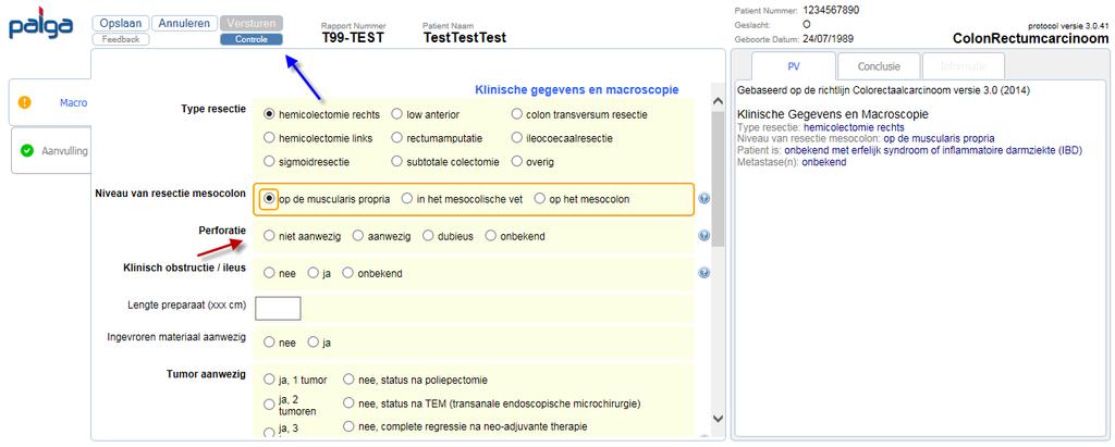 Handleiding Protocol Colonrectum Pagina 38 van 58 Controle knop Toelichting De functie van de Controle knop (blauwe pijl) is het in focus brengen van de eerst volgende openstaande verplichte rubriek