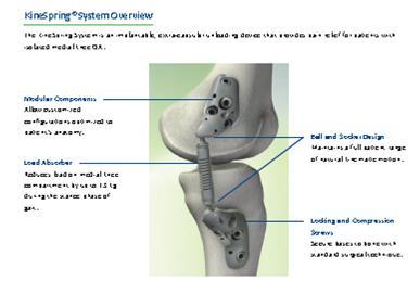 Over de knie (3) Interne distractor: Kinespring