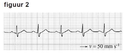 En nu zelf Oefenopgave 1 CE Havo 2016-II, vraag 11. Marloes heeft een cardiogram van de hartslag van haar baby. Met de hartslag wordt het aantal slagen van het hart per minuut bedoeld.