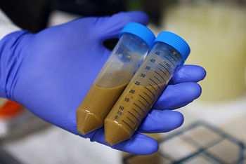 Microbiota van donoren met normaal gewicht verhoogt