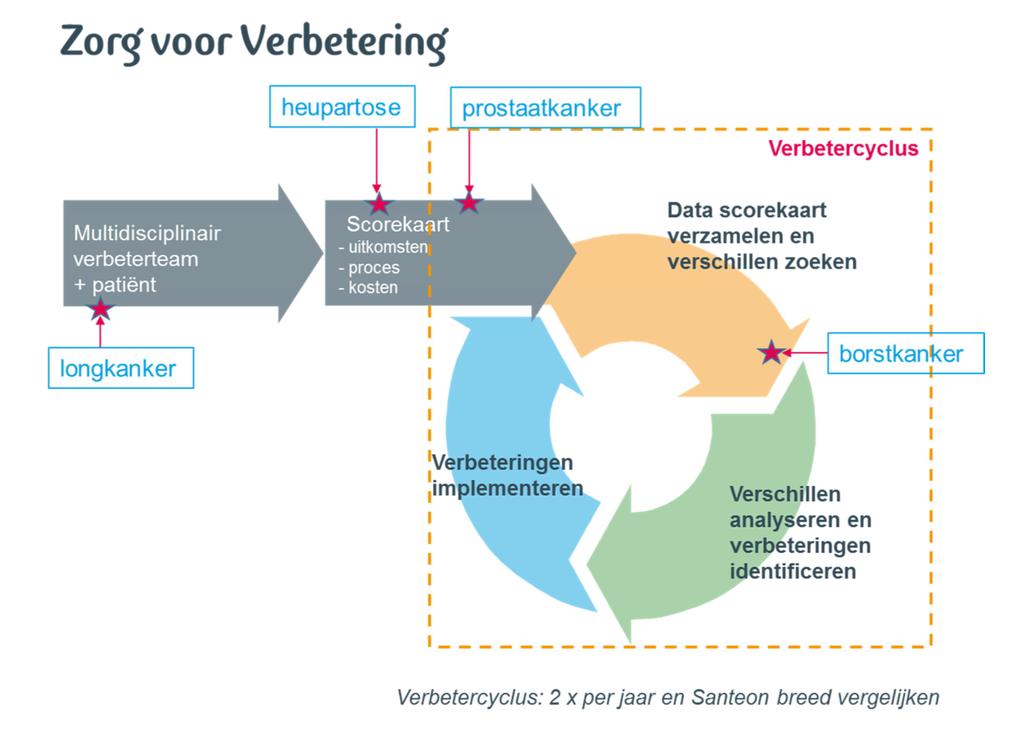 Santeon Zorg voor Verbetering Kritieke succesfactor: