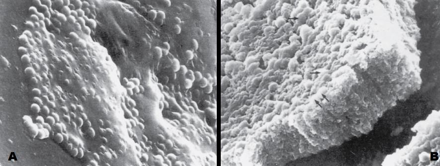 Figuur 3: CNS slijmvorming. A: Staphylococcus epidermis kokken op het oppervlakte van een katheter starten met het produceren van het extracellulaire polysaccharide slijm.