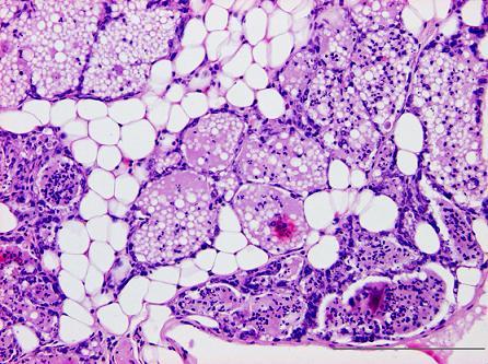 Figuur 39. Beeld van een histologische coupe van een muriene melkklier geïnjecteerd met 10 5 KVE S.