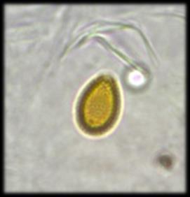 airallergy.be met de resultaten van de concentraties van de schimmelsporen.