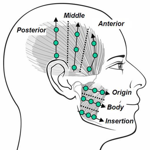 TMG dysfunctie en tinnitus Masticatory system
