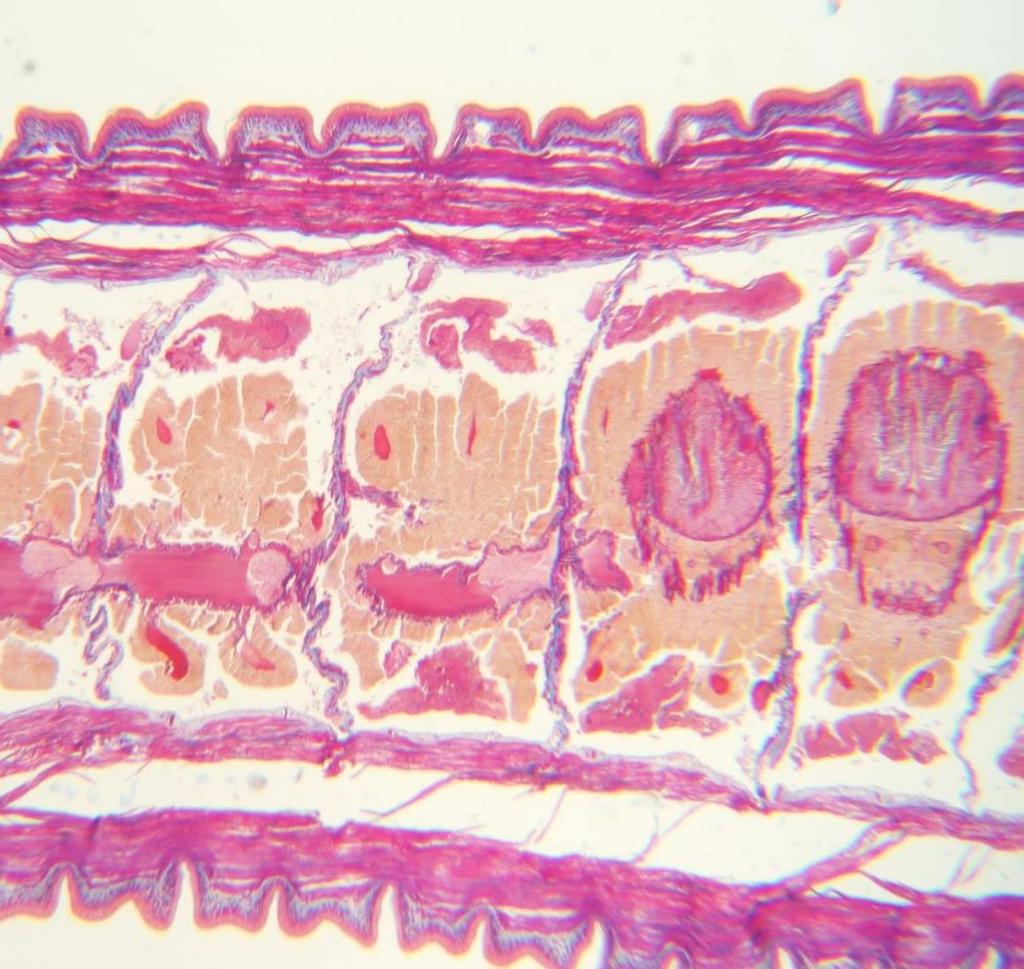 Darm langs cuticula en