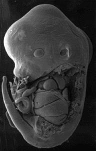 fertilization delivery Tijdlijn ontwikkeling embryo Genital tract Genital tract gonads teeth, palatine extremities eyes ears heart CNS, brain 0 1 week 2 3