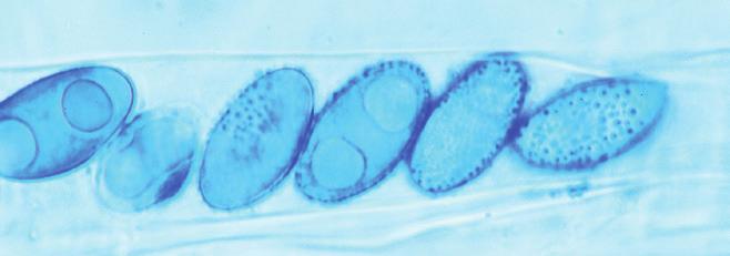 Het meest bijzonder is de microscopie. De asci zijn niet verankerd in een hymenium maar ontwikkelen zich her en der in draderig weefsel.