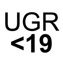 Hoog visueel comfort: Zeer fraaie en zachte verlichting van de ruimte Geen hinderlijke verblinding; de UGR is lager dan 19.