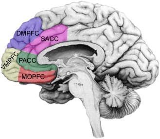 Afname inhiberende functie PFC Disregulatie: Gedrag Cognitie HPA-as MRI Volume afname: Orbitofrontale