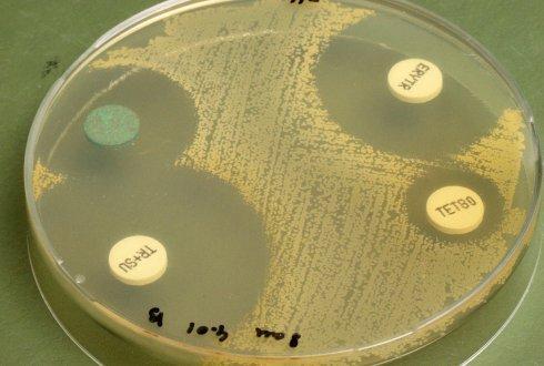 aantal nadelen: >70% van bijvoorbeeld fecale bacteriën is