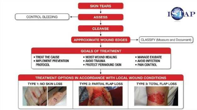 Type 2 skin tear: Partieel weefselverlies na repositionering van de flap Vele mogelijkheden Honing? Johnson C, KatzmanM.