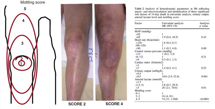 Figuur 1. De Mottling score is goed bed-side toepasbaar en mogelijk een voorspeller voor sterfte bij septische shock 2. Hoe kunnen we de circulatie meten?