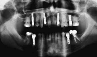 Bij deze patiënten had de huistandarts de gebitsontwikkeling afgewacht of was hij samen met een orthodontist een behandeling begonnen.