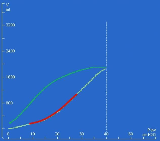 Werkwijze Bepalen of de longen recruitabel zijn Vorm van het inflatie been Lineaire compliantie Volumeverschil tussen inflatie been en