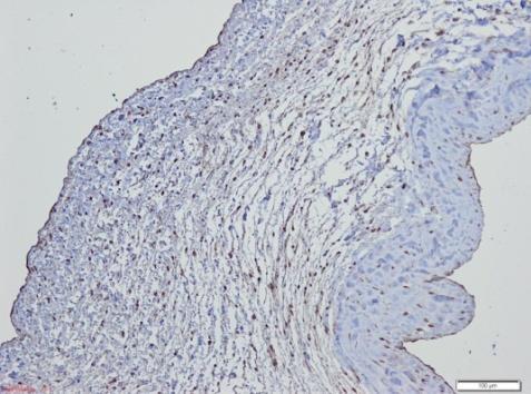 RESULTATEN A B C D Figuur 7: PECAM- kleuring m.b.v. protocol van een NGF gefixeerde oviene natieve hartklep. Schaal = 00 µm (7A, 7B en 7D); 50 µm (7C).