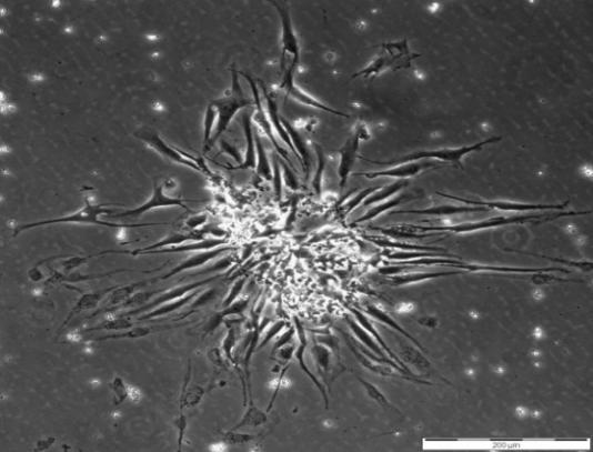 RESULTATEN voornamelijk een spoelvormig, fibroblast-like fenotype.