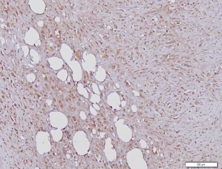 het schaapmodel antigen retrieval in