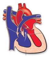 coarctatio aortae 5% transpositie van de grote vaten 5% atrioventriculair