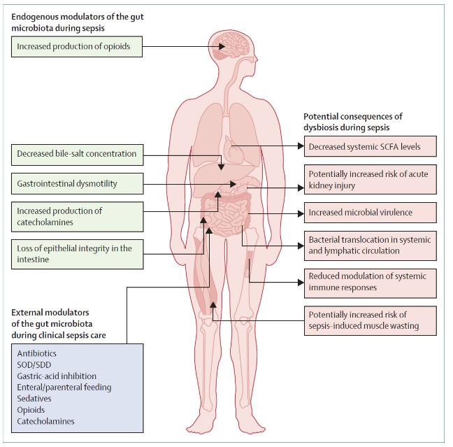 Causes and consequences of microbiota disruption in sepsis Dysbiosis in sepsis linked