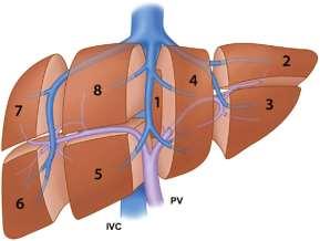 CAIRO5 Treatment strategies in colorectal cancer patients with initially unresectable liver-only metastases a