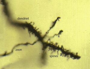 Volwassen hersenen bevatten biljarden synapsen Dendrieten met haarvormige uitstulpingen: de spines, waarop andere zenuwuitlopers via een synaps contact maken.