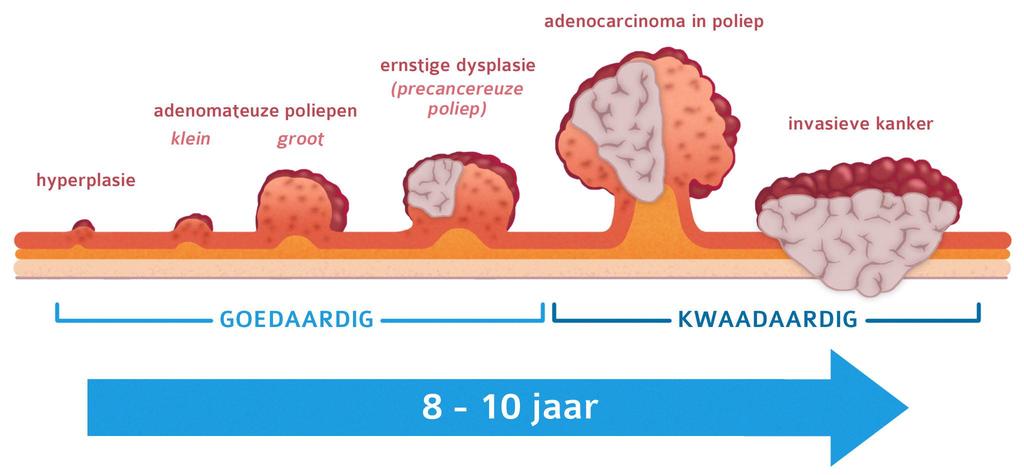 2.2 Vroege opsporing Door de trage ontwikkeling van poliepen kan DDK vaak vroegtijdig opgespoord worden.