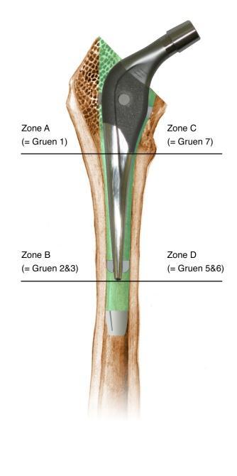 Scientific Hip Prosthesis vs. Omnifit Zone A bone 98 94 90 86 82 78 74 70 SHP Omnifit 1 wk 7 wks 3 mnths 6 mnths 1 yr 2 yrs DEXA - Resultaten Zone C bone P < 0.05 P < 0.