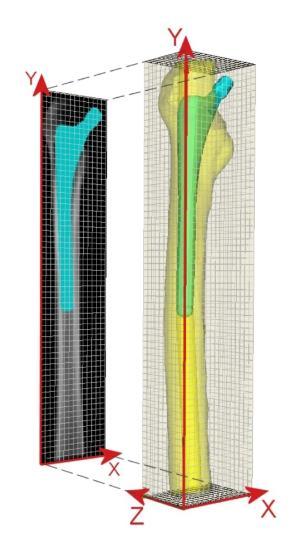Conversie van 3D remodellerings simulatie in 2D virtuele DEXA beelden Vergelijking van in vitro