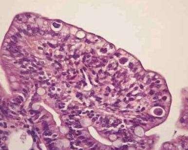 Koel bewaren voor transport Histologie: X Parasiet in darmcellen (verschillende