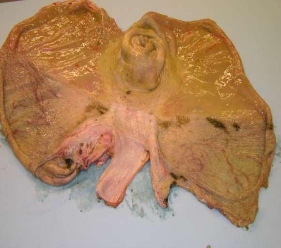 Maagulcera vleesvarken fokvarken Anatomie maag pars