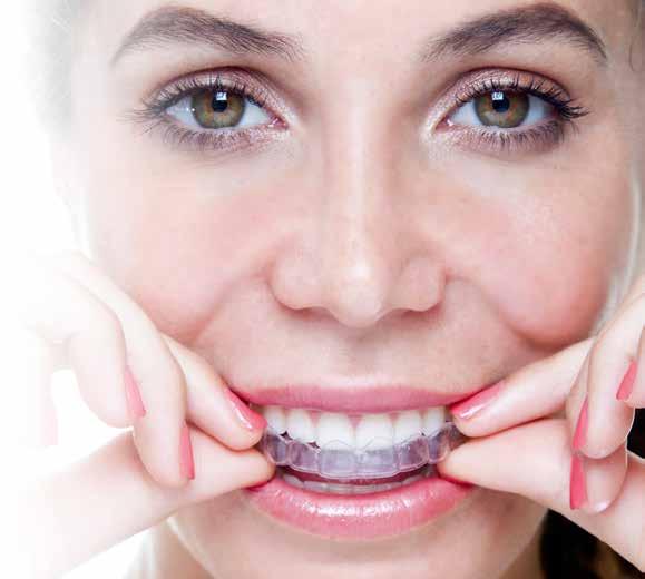 Onzichtbaar uw tanden recht! Regelmatig zijn mensen ontevreden over de stand van hun tanden.