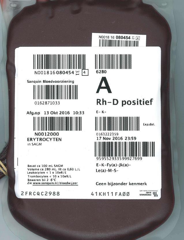 Preventie van K-immunisatie door transfusie Prevalentie van K-antigeen: 9% Alle Nederlandse donors zijn getypeerd voor: Rh-antigenen (C, c, D, E, e) en K Richtlijn Bloedtransfusie