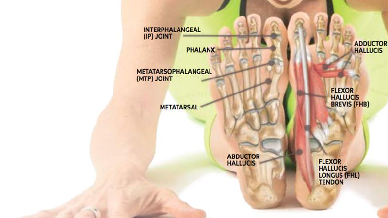 3.A. Voet controle: - Versterken van de voet musculatuur Motorische controle herstellen 3.B.