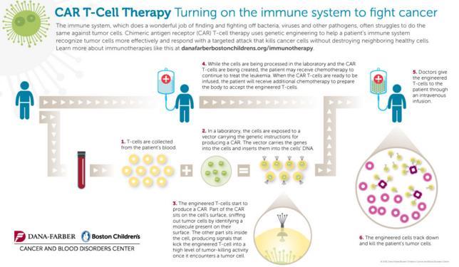 Figuur 15. Proces van de ontwikkeling van CAR T-cellen. 1) T-cellen worden verzameld uit het bloed van de patiënt.
