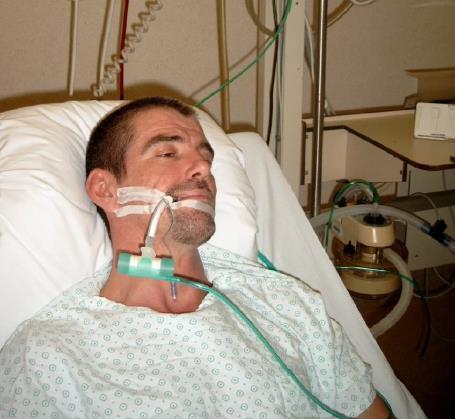 Spontaneous breathing trial (SBT) CPAP-ASB